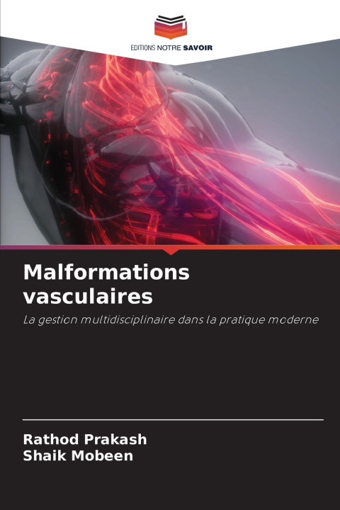 Kniha Malformations vasculaires Rathod Prakash