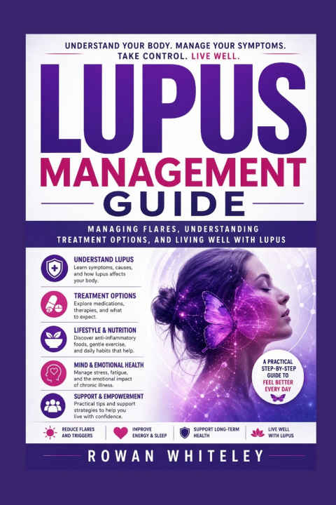 Kniha Lupus Management Guide Rowan Whitely