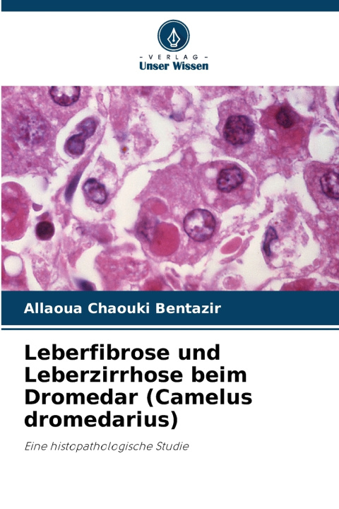 Knjiga Leberfibrose und Leberzirrhose beim Dromedar (Camelus dromedarius) Allaoua Chaouki Bentazir