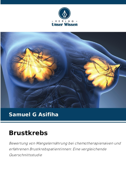 Knjiga Brustkrebs Samuel G Asifiha