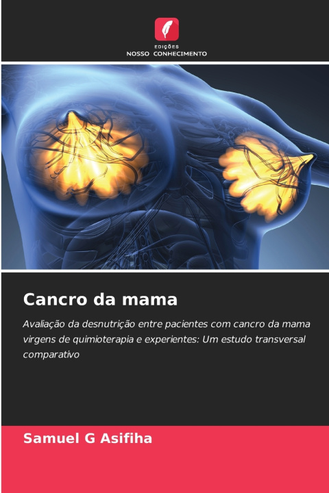 Kniha Cancro da mama Samuel G Asifiha