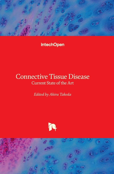 Kniha Connective Tissue Disease Akira Takeda