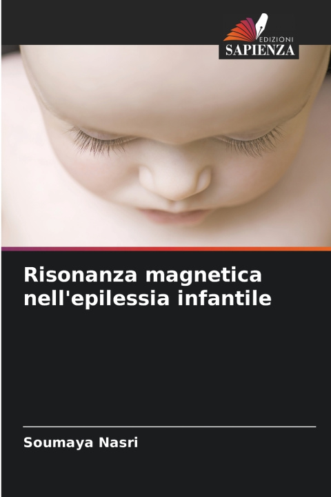 Knjiga Risonanza magnetica nell'epilessia infantile Soumaya Nasri