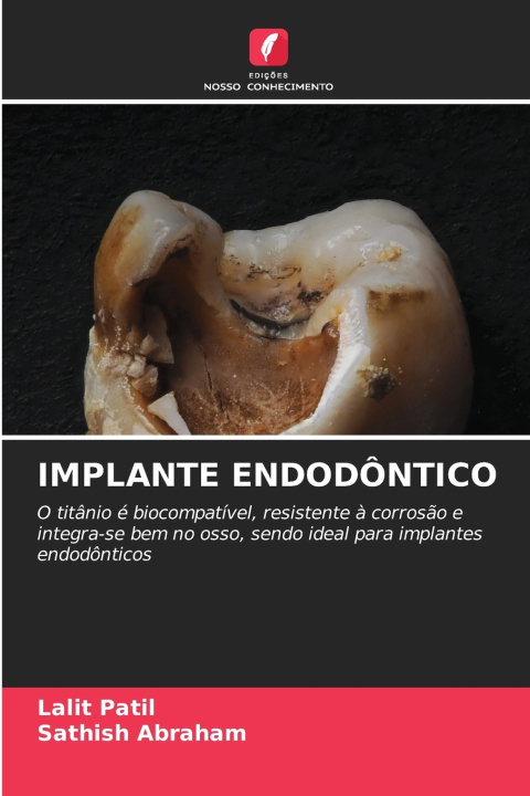 Kniha IMPLANTE ENDODÔNTICO Lalit Patil