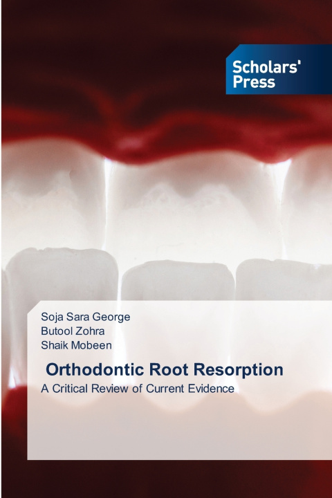 Kniha Orthodontic Root Resorption Soja Sara George