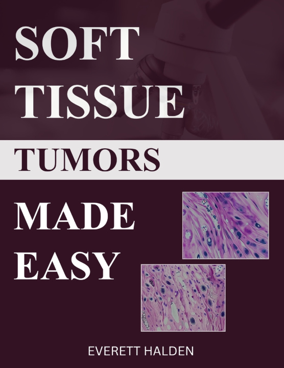 Knjiga Soft Tissue Tumors Made Easy Everett Halden