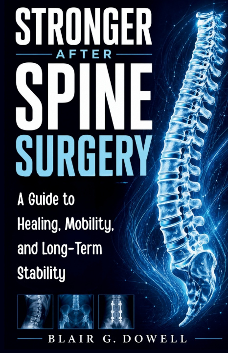 Kniha STRONGER AFTER SPINE SURGERY Blair G. Dowell