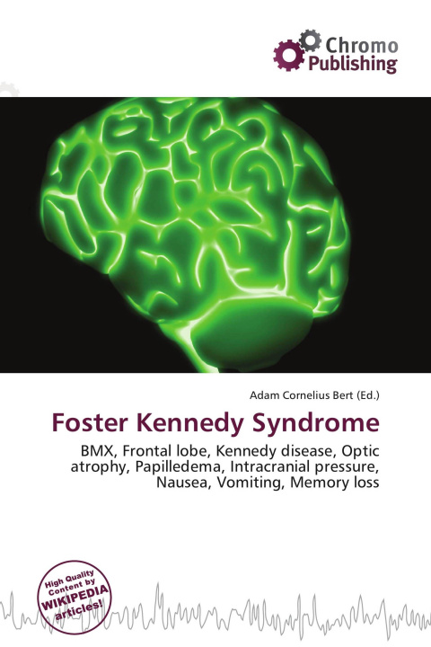 Kniha Foster Kennedy Syndrome 