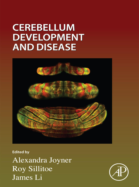 E-book Cerebellum Development and Disease Alexandra Joyner
