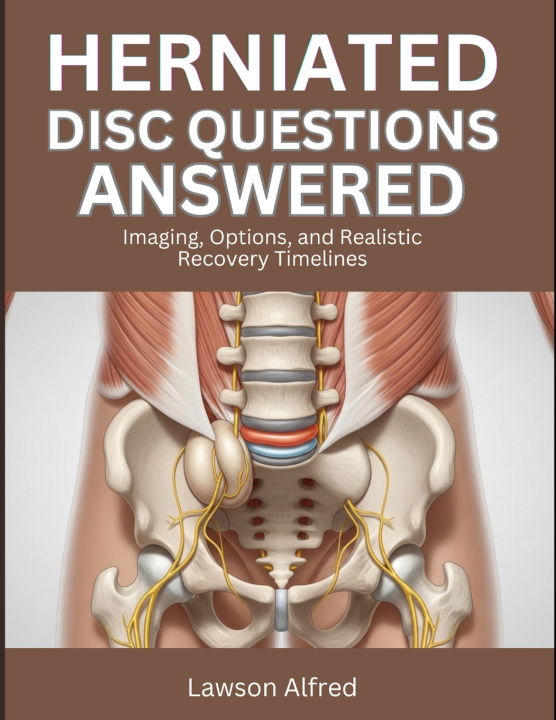 Kniha Herniated Disc Questions Answered Lawson Alfred
