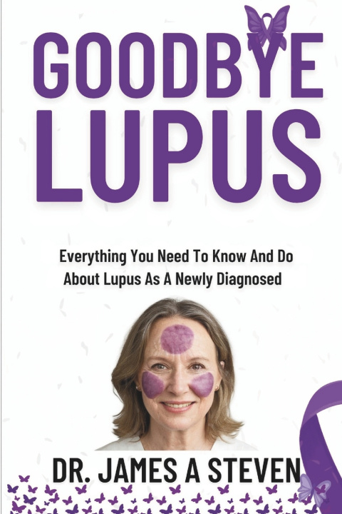 Kniha Goodbye Lupus James A Steven