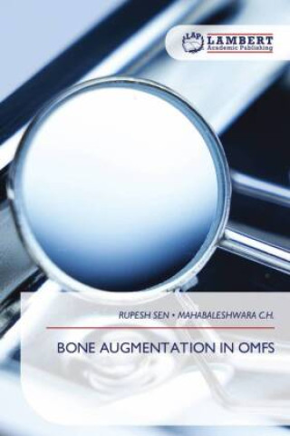 Kniha BONE AUGMENTATION IN OMFS RUPESH SEN