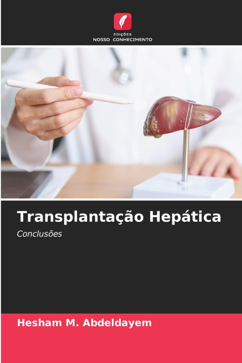 Kniha Transplantação Hepática Hesham M. Abdeldayem