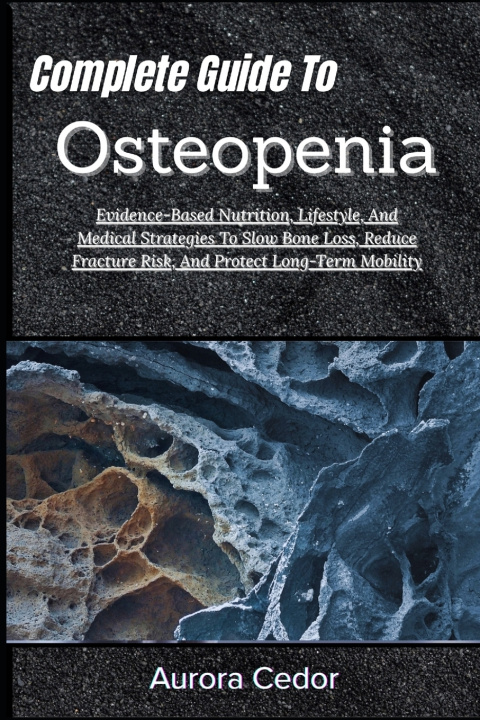 Kniha Complete Guide To Osteopenia Aurora Cedor