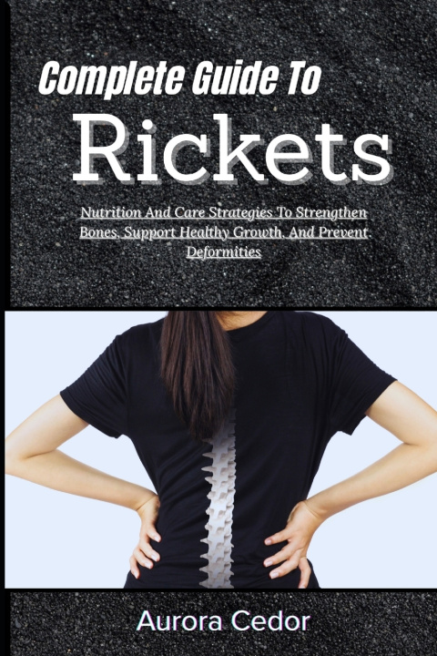 Kniha Complete Guide To Rickets Aurora Cedor