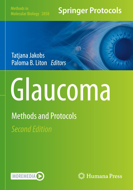 Könyv Glaucoma Tatjana Jakobs