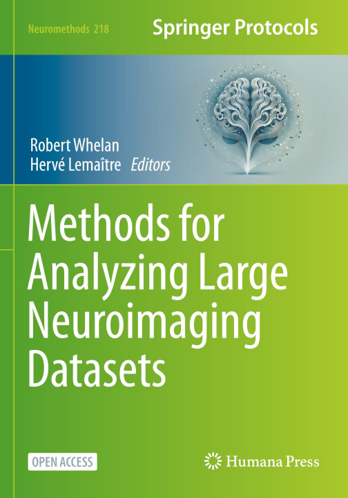 Kniha Methods for Analyzing Large Neuroimaging Datasets Robert Whelan