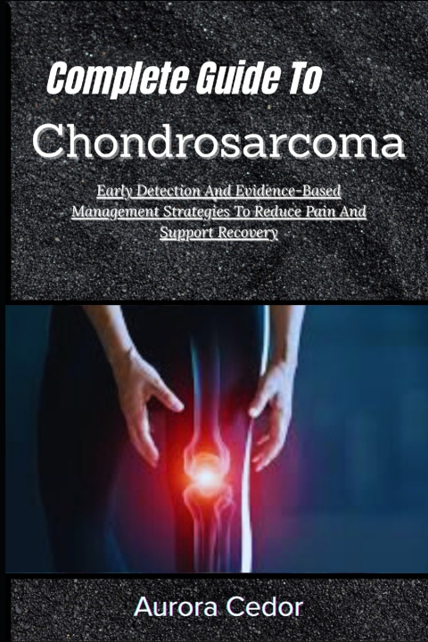 Kniha Complete Guide To Chondrosarcoma Aurora Cedor