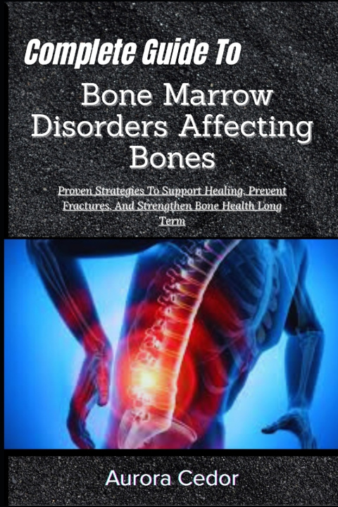 Kniha Complete Guide To Bone Marrow Disorders Affecting Bones Aurora Cedor