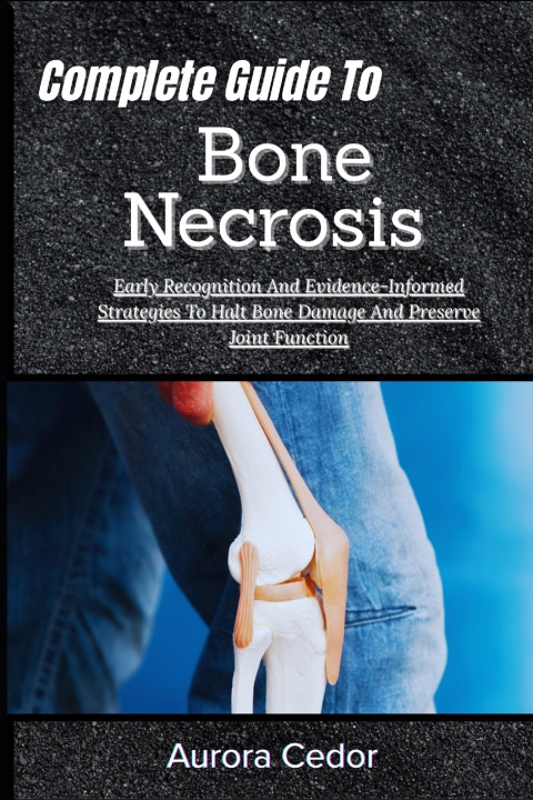 Kniha Complete Guide To Bone Necrosis Aurora Cedor