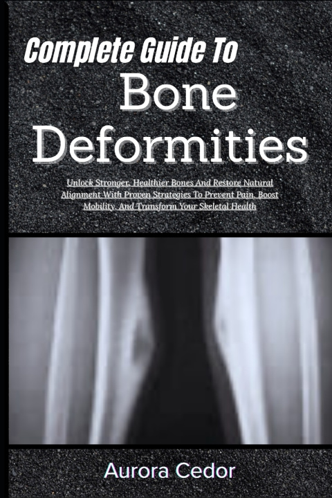 Kniha Complete Guide To Bone Deformities Aurora Cedor