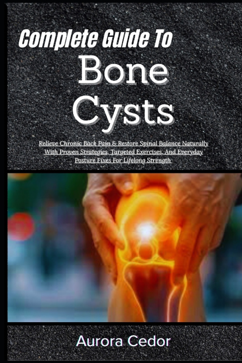Knjiga Complete Guide To Bone Cysts Aurora Cedor