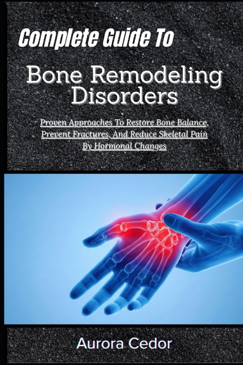 Kniha Complete Guide To Bone Remodeling Disorders Aurora Cedor