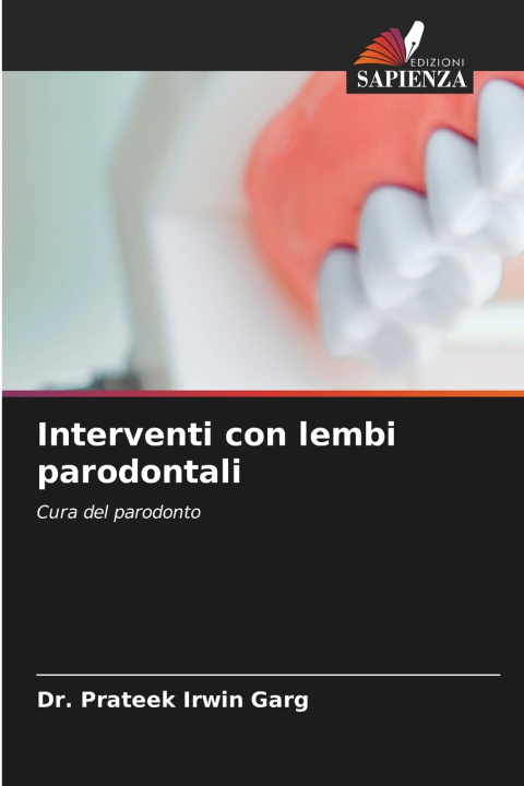 Knjiga Interventi con lembi parodontali Dr. Prateek Irwin Garg