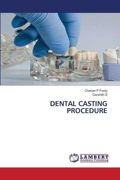 Kniha DENTAL CASTING PROCEDURE Cherian P Fredy