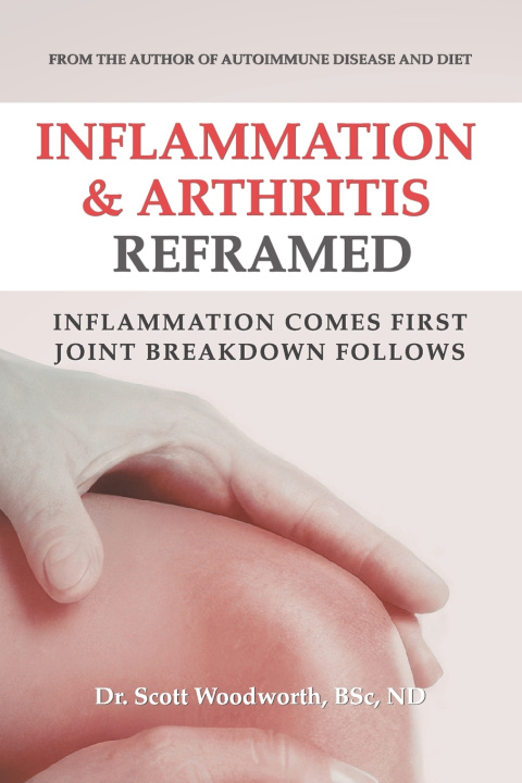 Kniha Arthritis & Inflammation Reframed Scott Woodworth ND