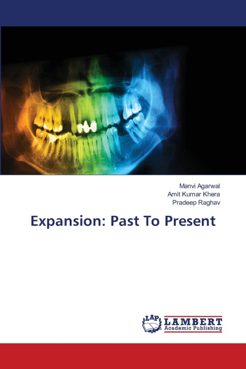 Kniha Expansion Manvi Agarwal