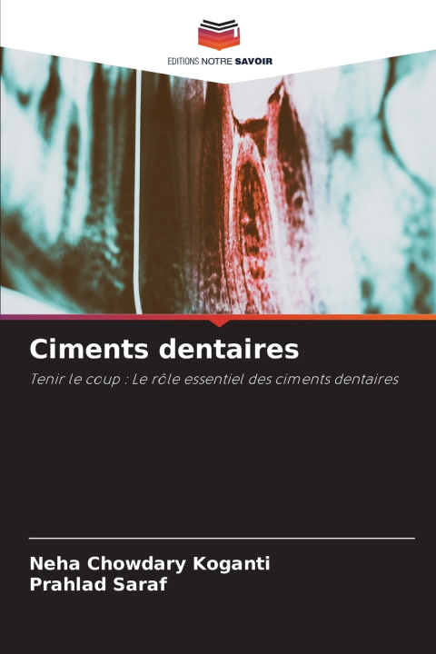 Kniha Ciments dentaires Neha Chowdary Koganti
