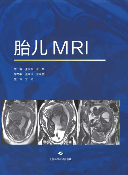 Knjiga Fetal MRI/胎儿MRI 张国福 张鹤 主编