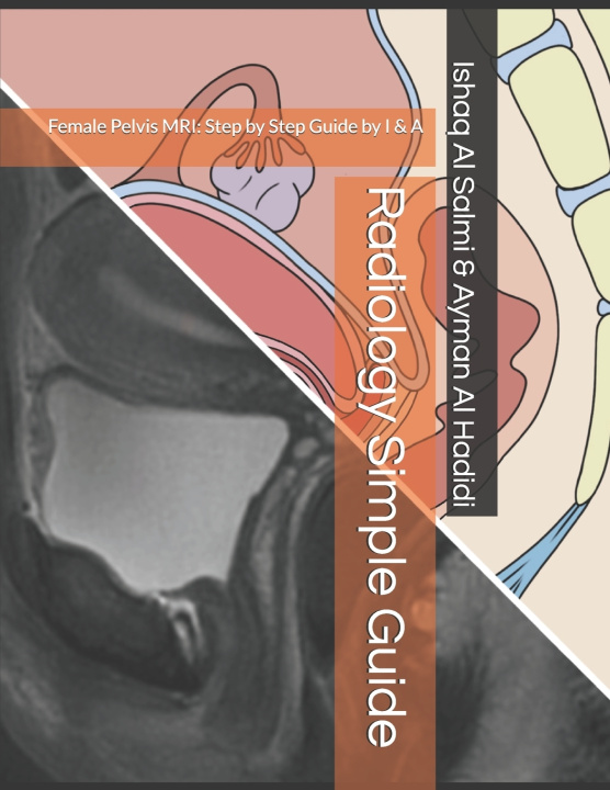 Kniha Radiology Simple Guide Ayman Al Hadidi