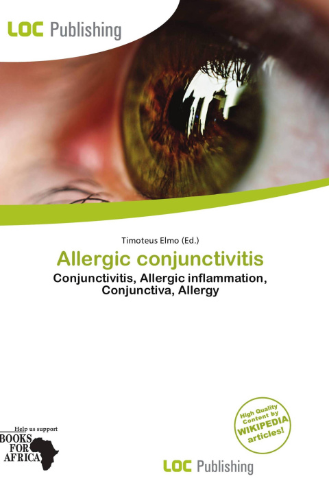 Book Allergic conjunctivitis 