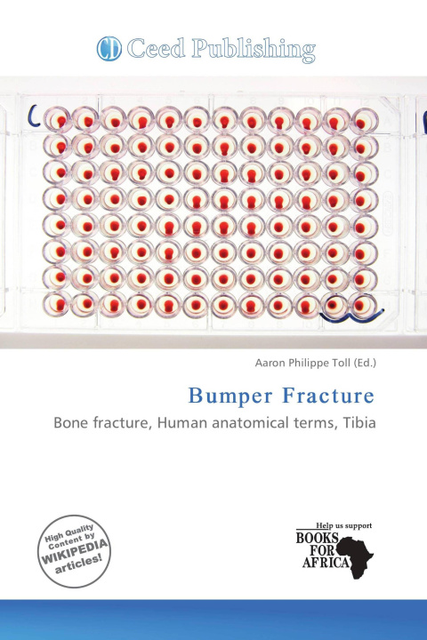 Книга Bumper Fracture 