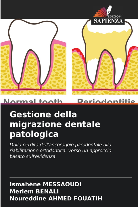 Boek Gestione della migrazione dentale patologica Ismahène MESSAOUDI