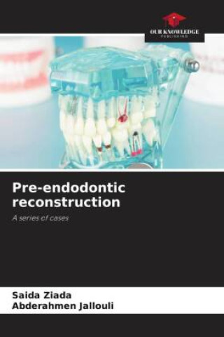 Книга Pre-endodontic reconstruction Abderahmen Jallouli
