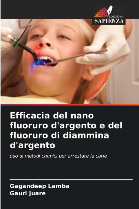 Buch Efficacia del nano fluoruro d'argento e del fluoruro di diammina d'argento Gagandeep Lamba