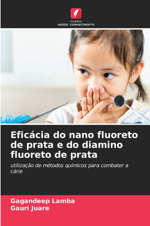Boek Eficácia do nano fluoreto de prata e do diamino fluoreto de prata Gagandeep Lamba