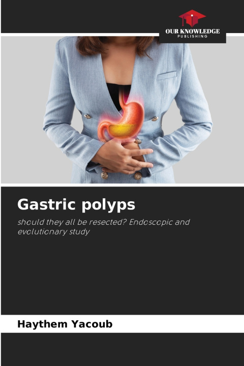 Könyv Gastric polyps Haythem Yacoub