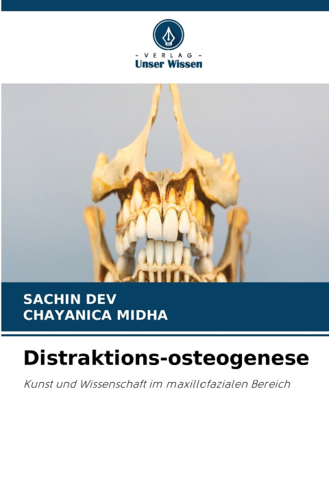 Книга Distraktions-osteogenese Chayanica Midha