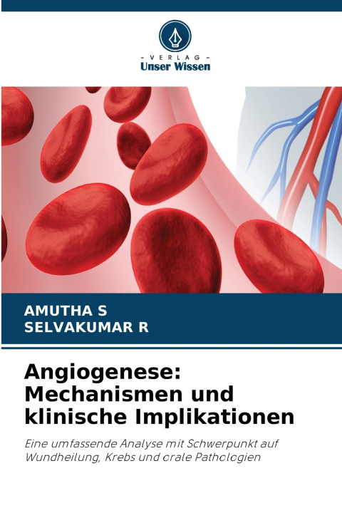 Carte Angiogenese AMUTHA S