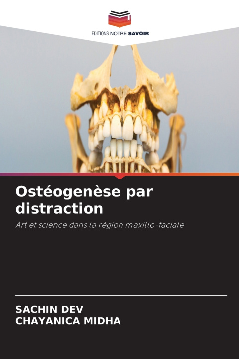 Buch Ostéogenèse par distraction SACHIN DEV