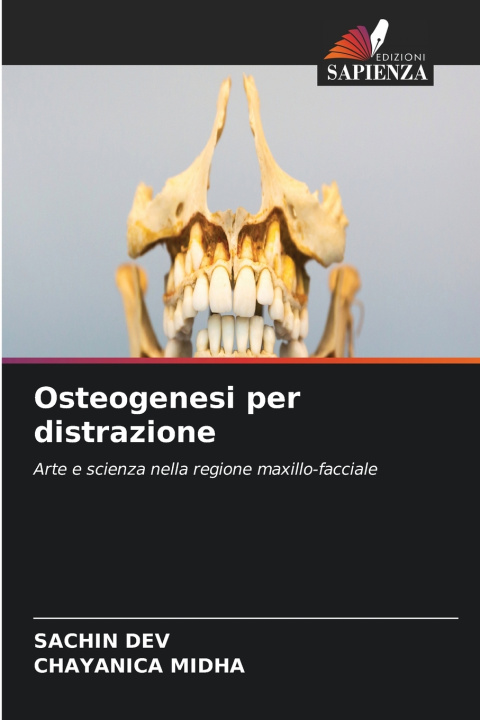 Könyv Osteogenesi per distrazione Chayanica Midha