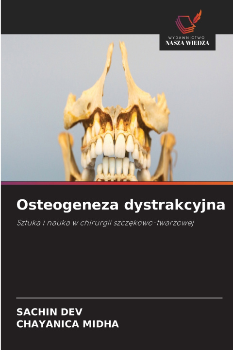 Carte Osteogeneza dystrakcyjna Chayanica Midha