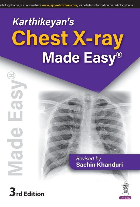 Książka Karthikeyan's Chest X-Ray Made Easy Sachin Khanduri