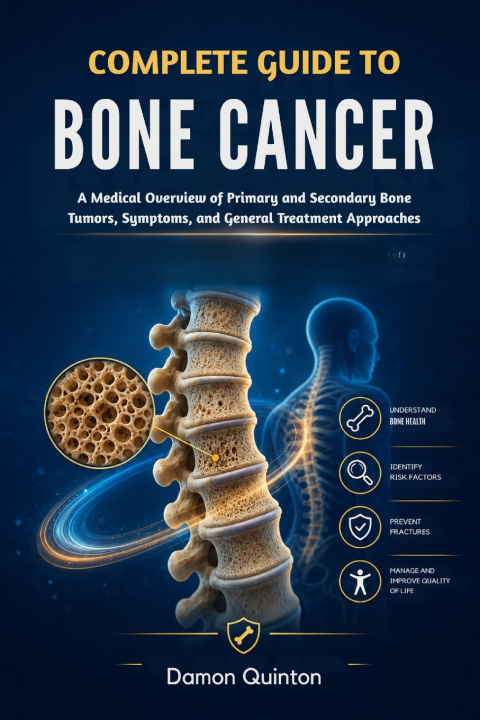 Buch Complete Guide To Bone Cancer Damon Quinton