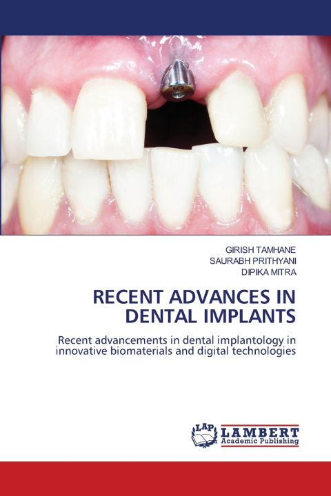 Carte RECENT ADVANCES IN DENTAL IMPLANTS GIRISH TAMHANE
