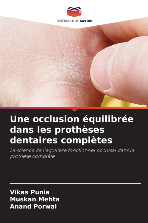 Carte Une occlusion équilibrée dans les prothèses dentaires complètes Vikas Punia